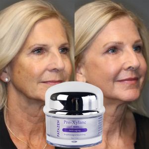 FATAZEN Pro-xylane face cream skin moisturizer