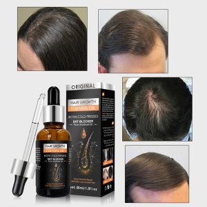 FATAZEN Hair Growth Essential Oil
