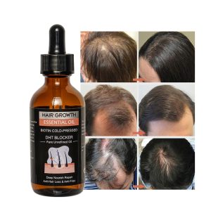 FATAZEN All Natural Formula Hair Growth Oil Serum Nourishing Scalp Rapid Hair Growth Oil Organic Hari Oil